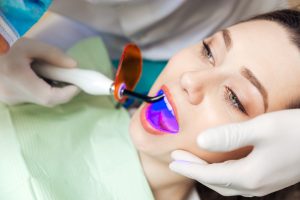 Root canal Therapy Brampton