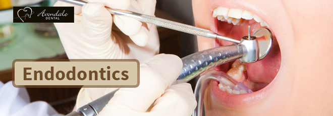 endodontist brampton