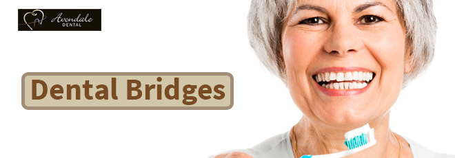 dental bridges brampton