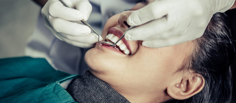 Dental Crowns Brampton